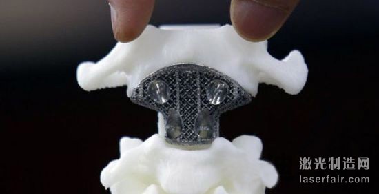深圳成立臨床醫學3D打印技術轉化研究中心